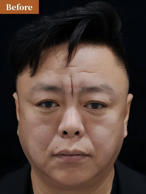 瑞康24小时在线套医保微信能用吗怎么弄？官方解答来了